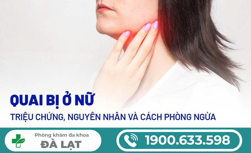 Hình ảnh minh họa